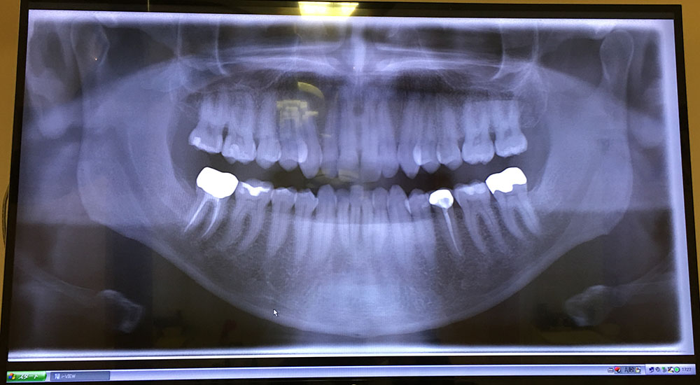 new dentist's x-ray